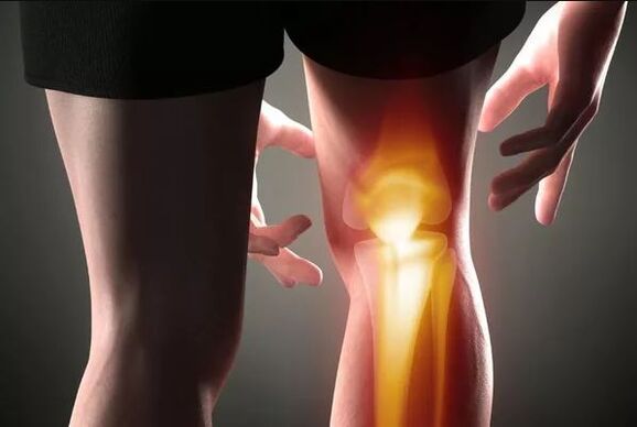 Arthrosis vum Knéi Gelenk