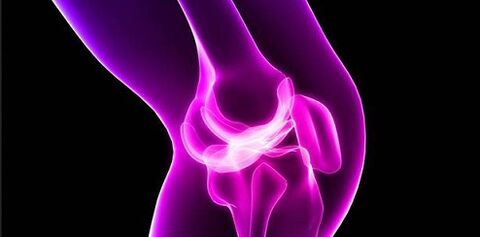 Arthrosis am Knéi Gelenk