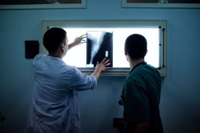 Diagnos vun Arthrosis op X -ray