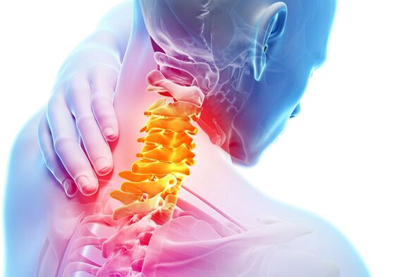 Zervikal Osteochondrose