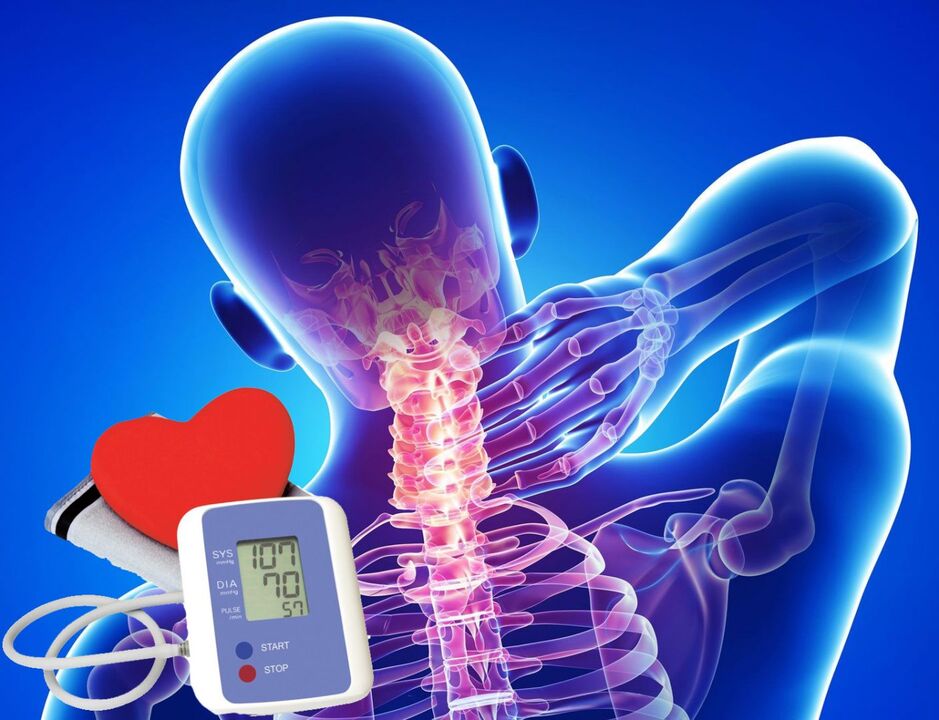 Spréngt am Blutdrock mat zervikaler Osteochondrose