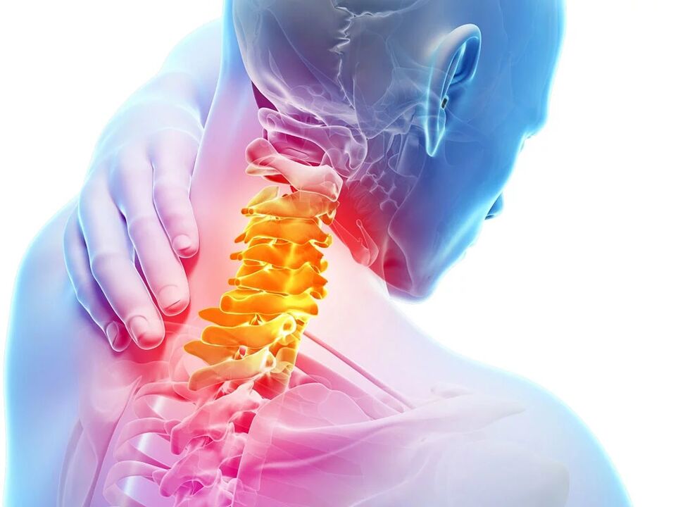 Zervikal Osteochondrose