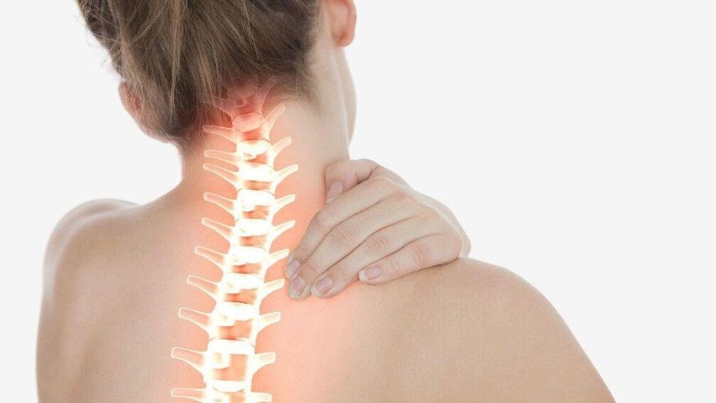 Mat Osteochondrose vun der Gebärmutterhalskierch kann Radikulär Syndrom entwéckelen