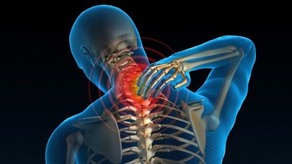 Péng beim Hals dréien kann vertebral Gebärmutterkierper Osteochondrose Syndrom weisen
